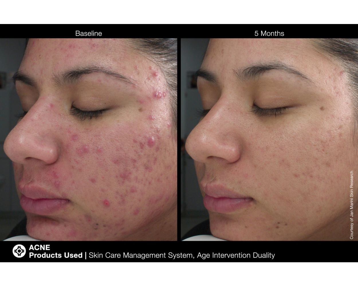 laser hair removal training, lip blush training, body contouring, medical esthetics, spa studio, facial, facial near me, laser hair removal near me, hydrafacial near me, body sculpting, laser clinic