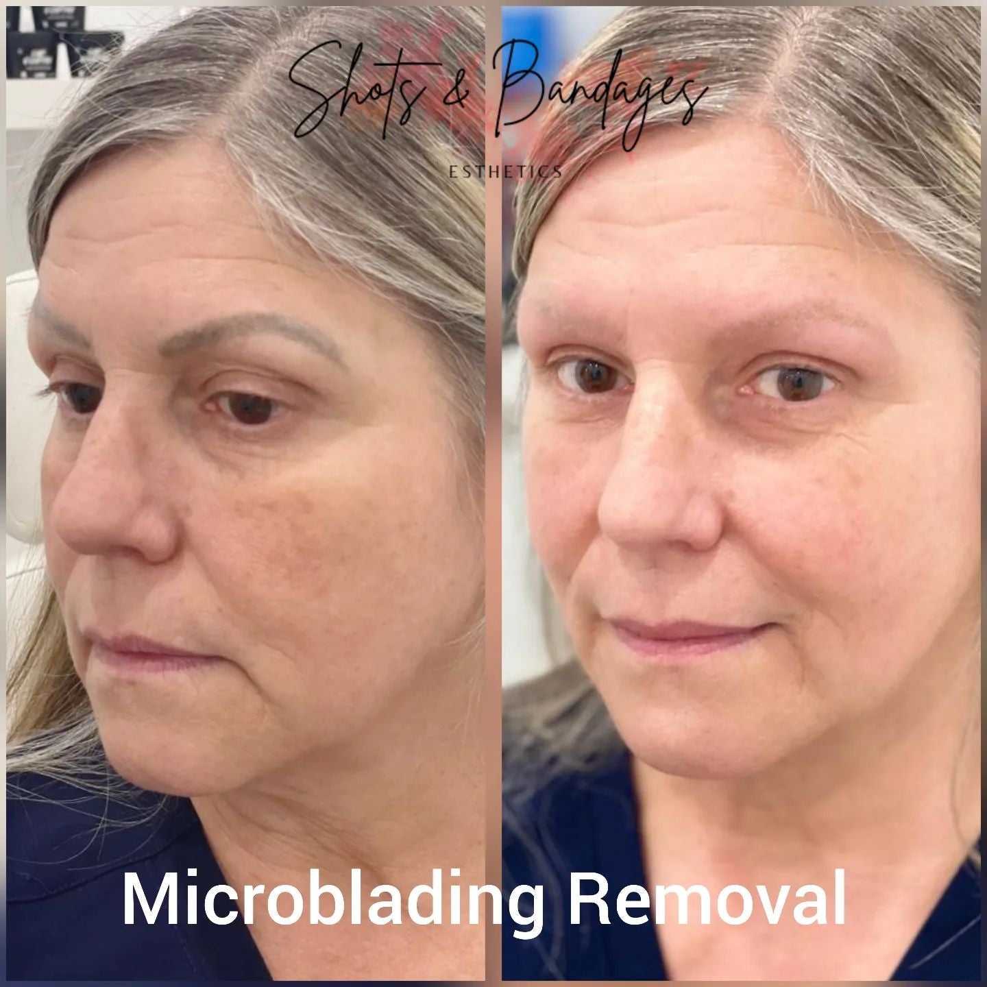 laser hair removal training, lip blush training, body contouring, medical esthetics, spa studio, facial, facial near me, laser hair removal near me, hydrafacial near me, body sculpting, laser clinic