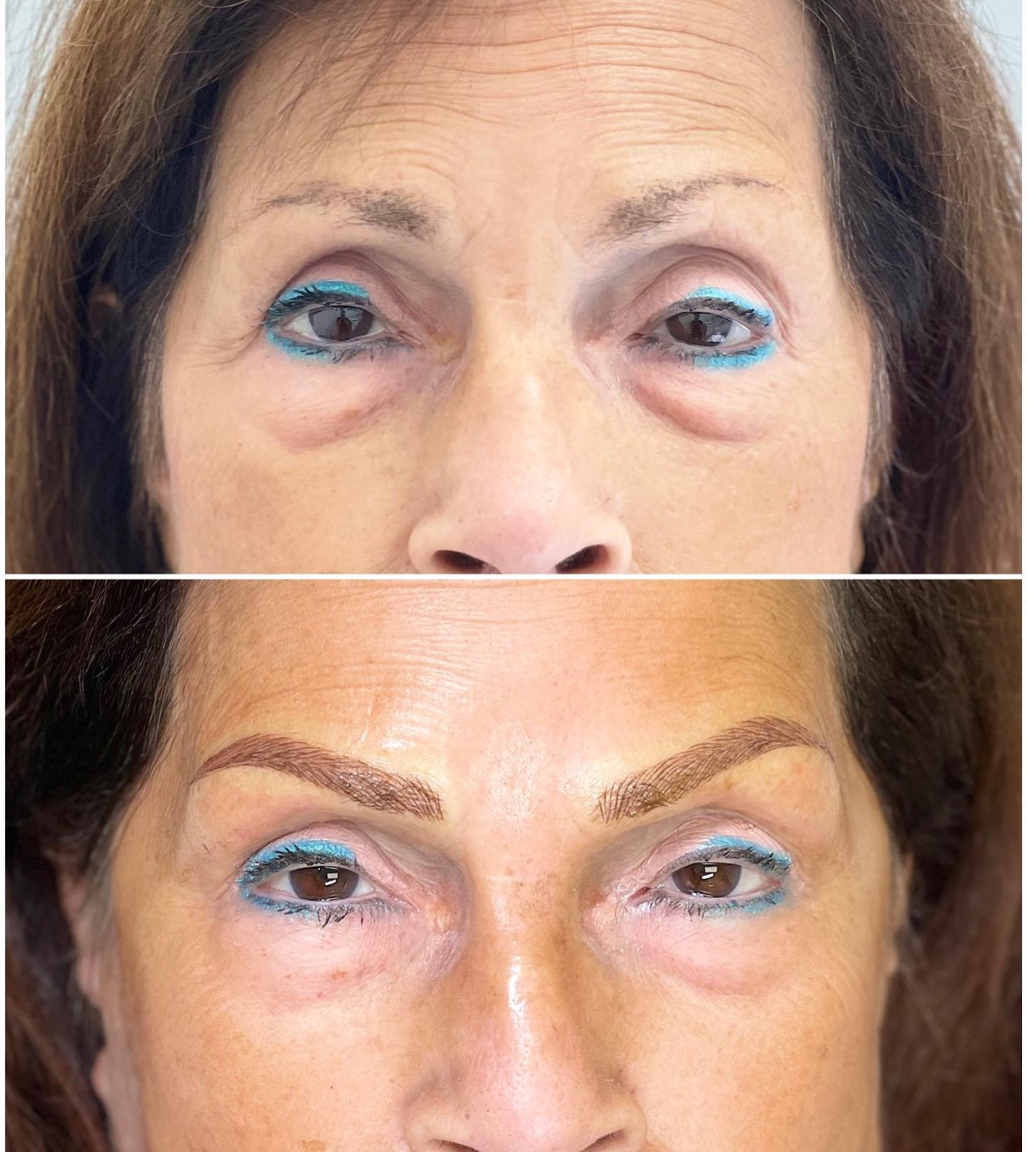 laser hair removal training, lip blush training, body contouring, medical esthetics, spa studio, facial, facial near me, laser hair removal near me, hydrafacial near me, body sculpting, laser clinic