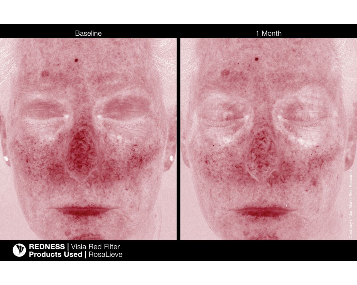 Rosalieve Redness Reducing Complex