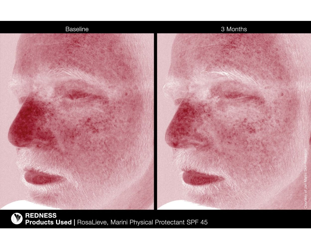 Rosalieve Redness Reducing Complex